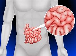 Image result for intestino