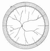 Image result for Basics of Fundus Retina Drawing