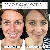 Image result for Red and Itchy After Tanning Bed