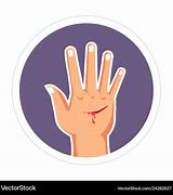 Image result for Hand Injury Cartoon