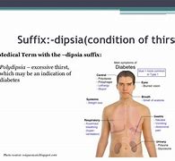 Image result for zdipsia