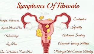 Image result for 5 Cm Fibroid Size