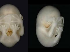 Image result for Baby Bat in the Womb