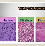 Image result for cartilaginoao