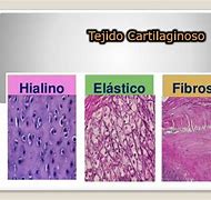 Image result for cartilagonoso