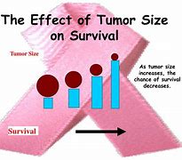 Image result for Stages of Cancer Tumor Size