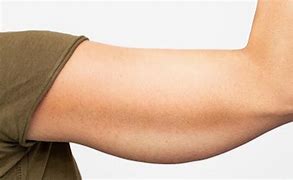 Image result for Arm Skin