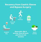Image result for SB Bypass Surgery for Weight Loss