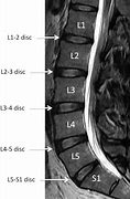 Image result for S3 S4 Spine