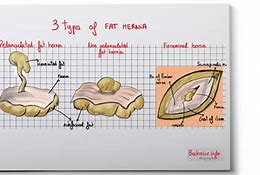 Image result for What Does Fat Look Like through a Cut