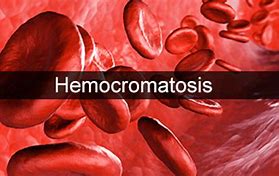 Image result for hemocromatosis