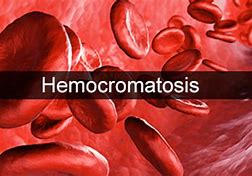 Image result for hemocromayosis