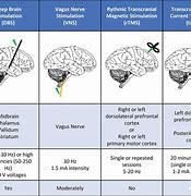 Image result for Electric Brain Stimulation