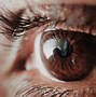 Image result for First Lasik Eye Surgery
