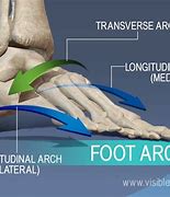 Image result for Transverse Arch Foot