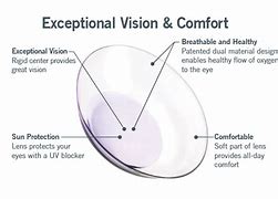 Image result for contacts lens for astigmatism