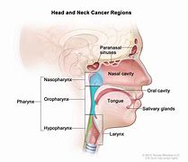 Image result for Head and Neck Cancer Solution