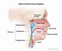 Image result for Unresectable Head and Neck Cancer