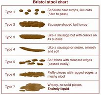 Image result for Types of Stools Bowel Movements