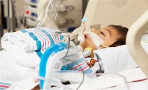 Image result for Patient with Ventilator