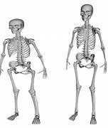 Image result for WW1 Skeletons