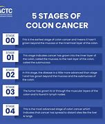 Image result for Colon Cancer Final Stage