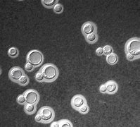 Image result for cryptococcus_neoformans