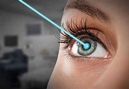 Image result for Laser Eye Surgery Clip Art