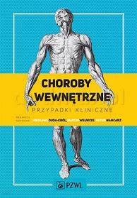 Image result for choroby_wewnętrzne