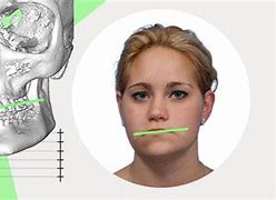 Image result for Asymmetrical Jaw