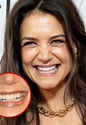 Image result for Katie Holmes Teeth Whitening Kit