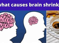Image result for Shrinking Brain Sayings