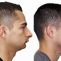 Image result for Small Chin Men