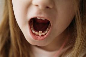 Image result for Born with Sharp Teeth