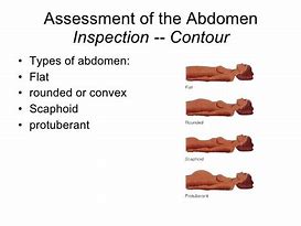 Image result for abdoma