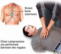 Image result for CPR Chest Compressions