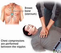 Image result for CPR Chest Compressions