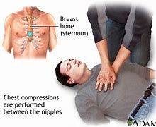 Image result for Chest Compressions for Adult CPR