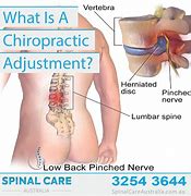 Image result for What Does a Chiropractor Do