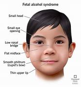 Image result for alxohol�metro