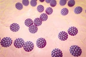 Image result for HPV Genital Warts Disease