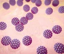 Image result for HPV Genital Warts