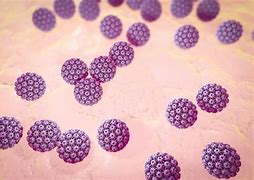 Image result for HPV Genital Warts Pictures