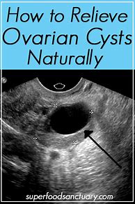 Image result for Ovarian Cyst Lower Back Pain