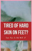 Image result for Harden Skin On Feet