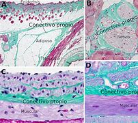 Image result for fibroso