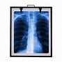 Image result for Portable X-ray View Box