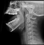 Image result for Jaw Joint Anatomy