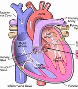 Image result for Heart Murmur Aortic Stenosis