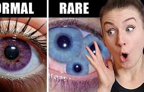Image result for Top 10 Rarest Eye Colors